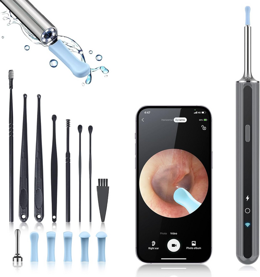 Wireless Ear Wax Removal Kit – 1080P HD Otoscope with LED & 7 Ear Picks
